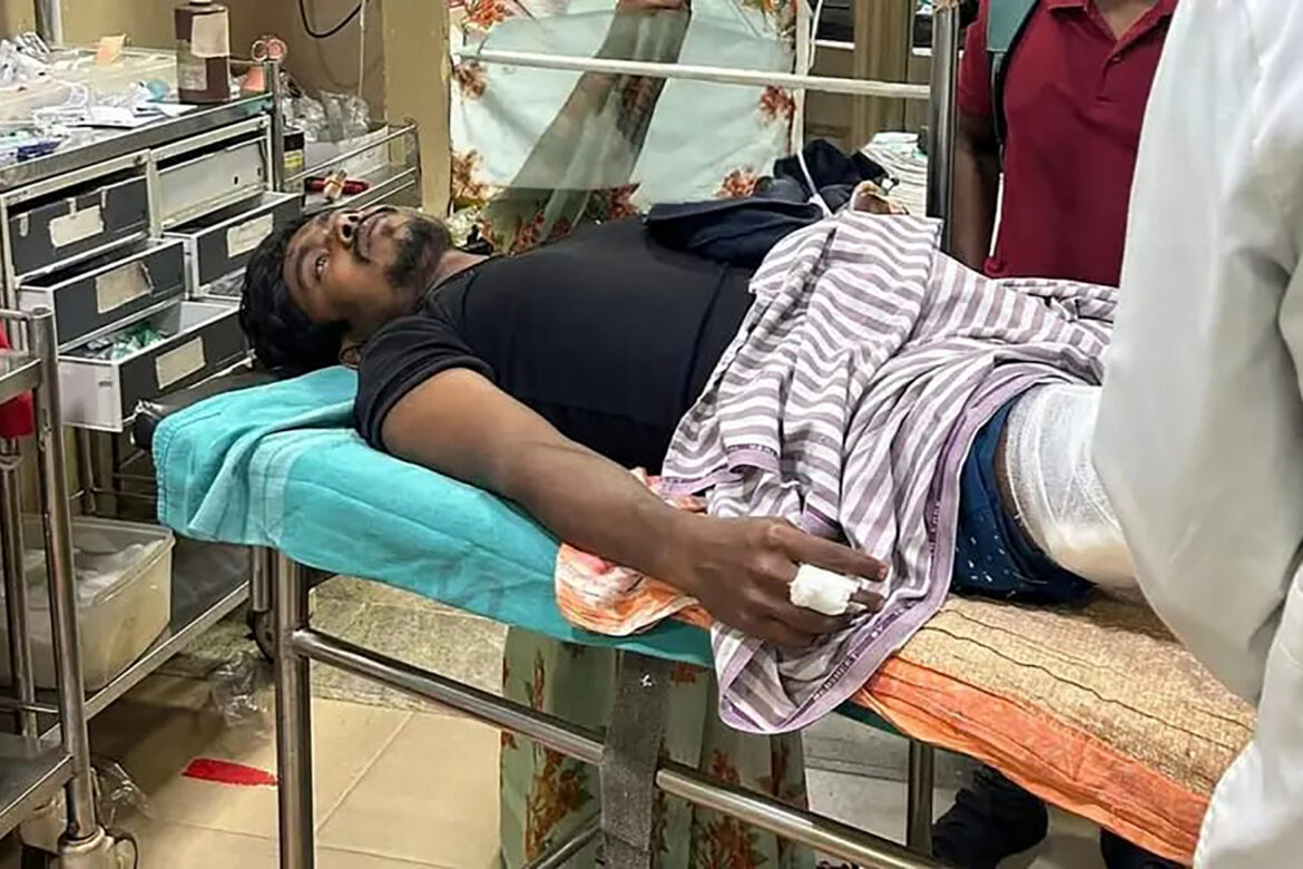 Farmer injured in bear attack
